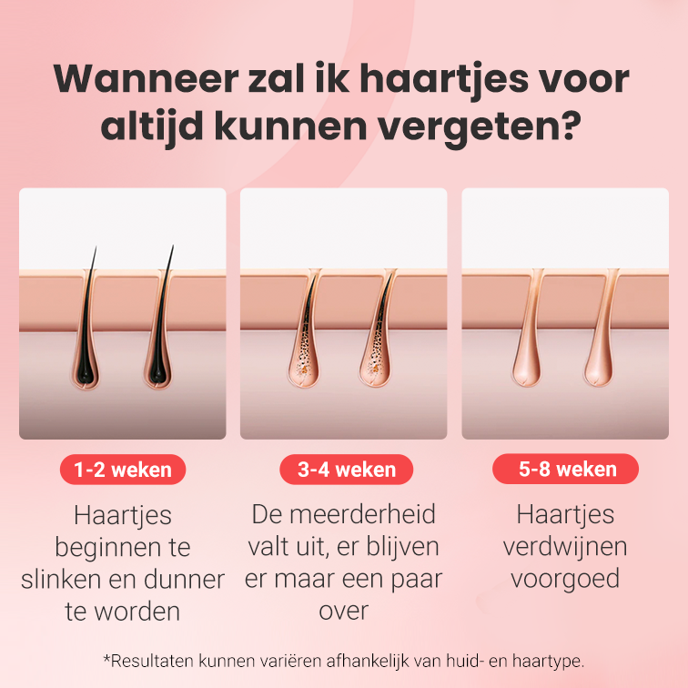IPL foto-epilator